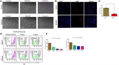 Angiogenic Gene Signature Derived from Subtype Specific Cell Models Segregate Proneural and Mesenchymal Glioblastoma